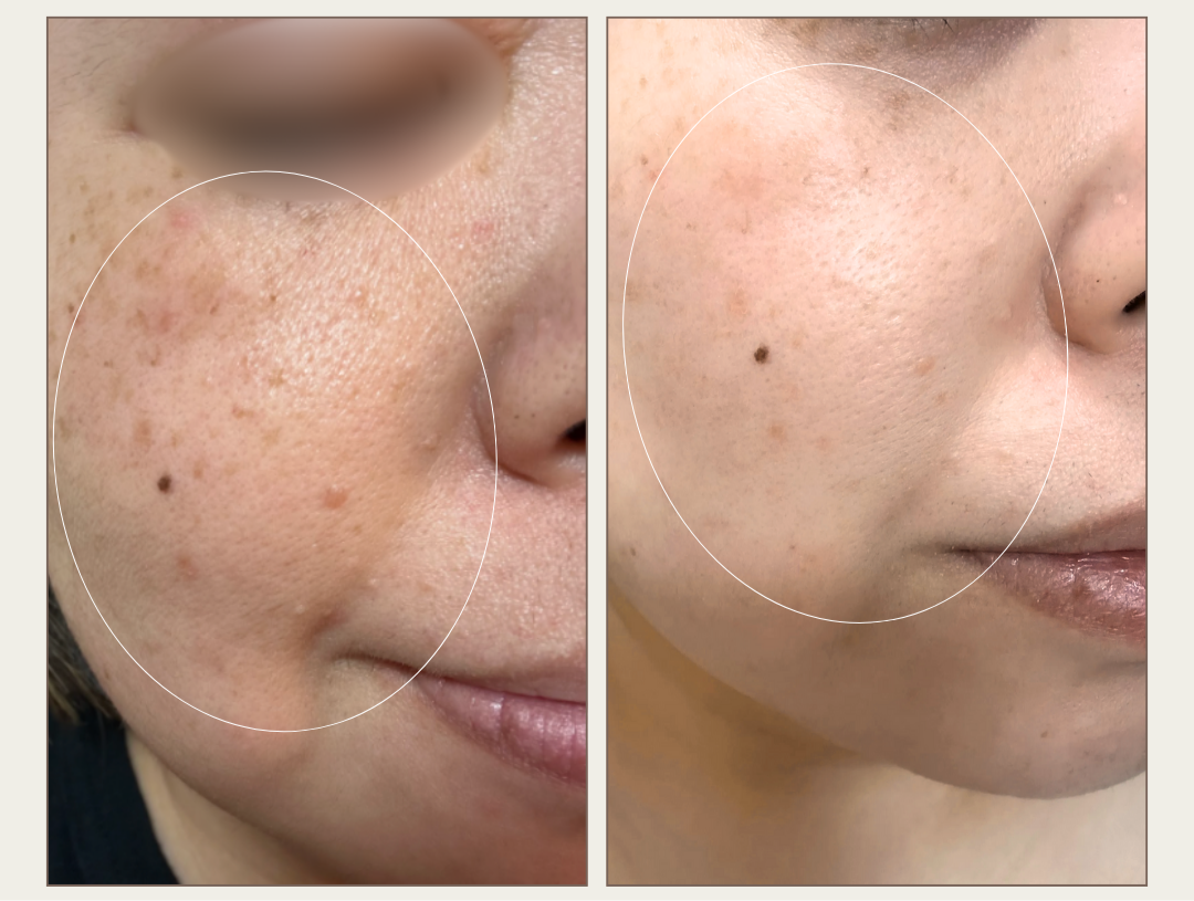 Before / After