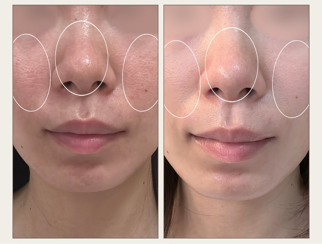 Before / After