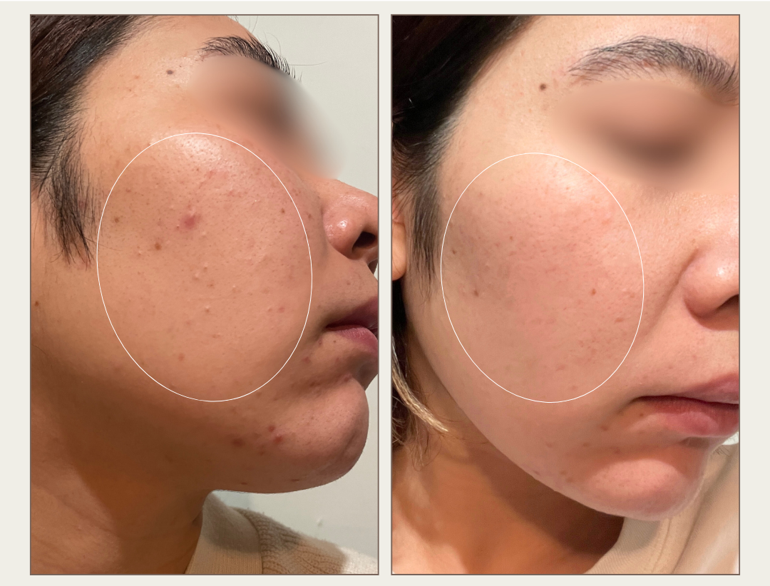 Before / After